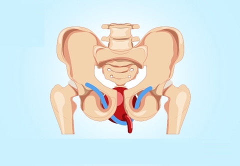 Vì sao hay có rối loạn tiết niệu sau mổ ung thư trực tràng